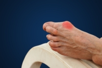 What to Do About a Bunion